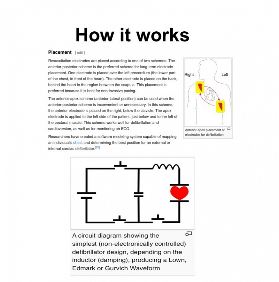 HOW A DEFIBRILLATOR WORKS